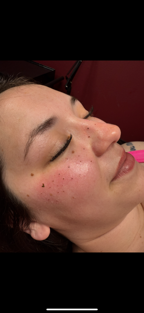 Freckle Tattoo