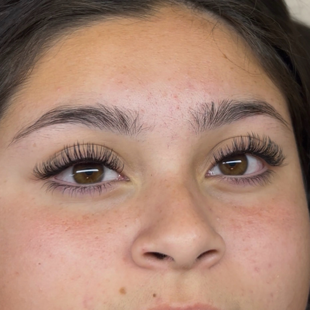 Classic Set at Amor Esthetics in Goodyear, AZ