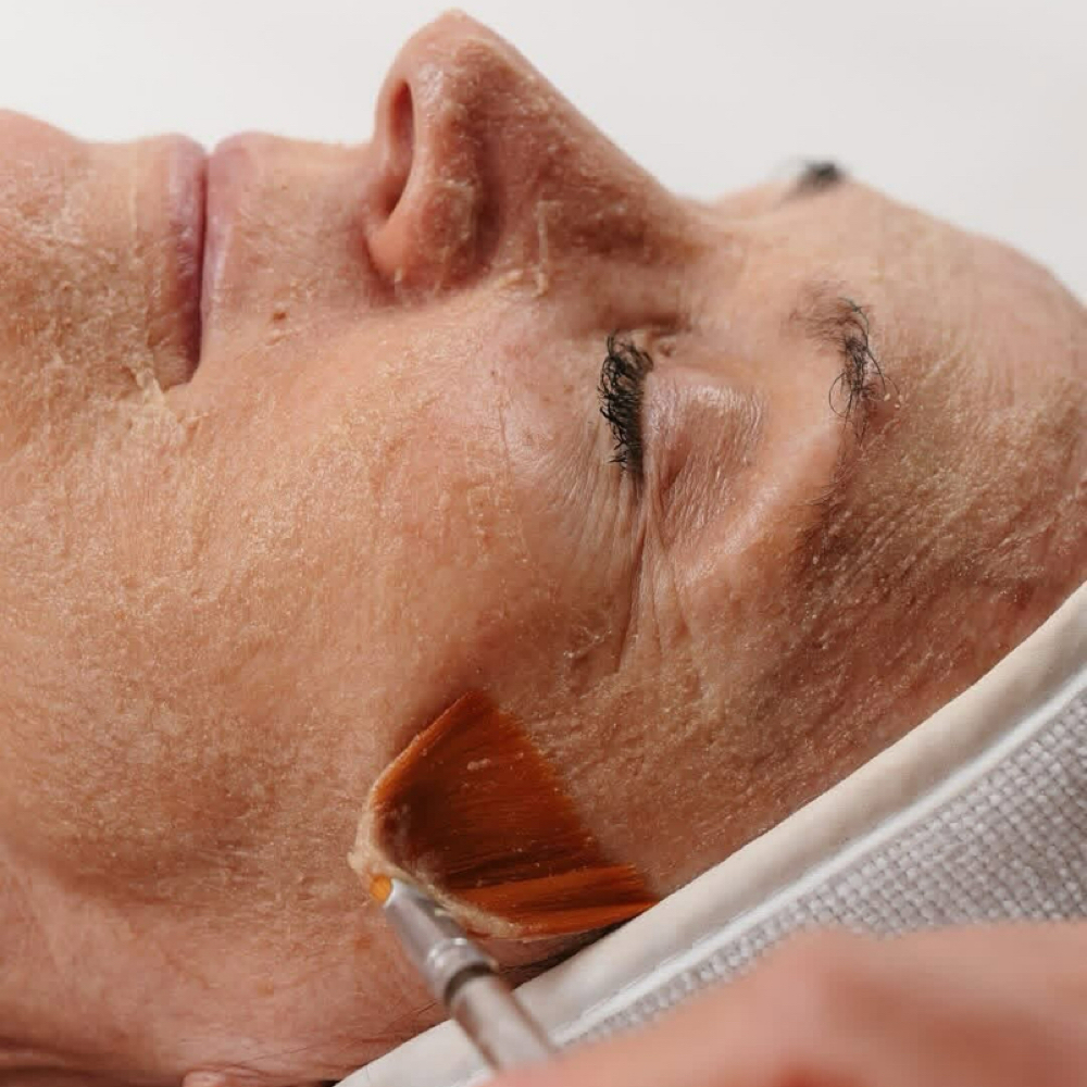 The Express Facial at Mla.Aesthetics in Grants Pass, OR