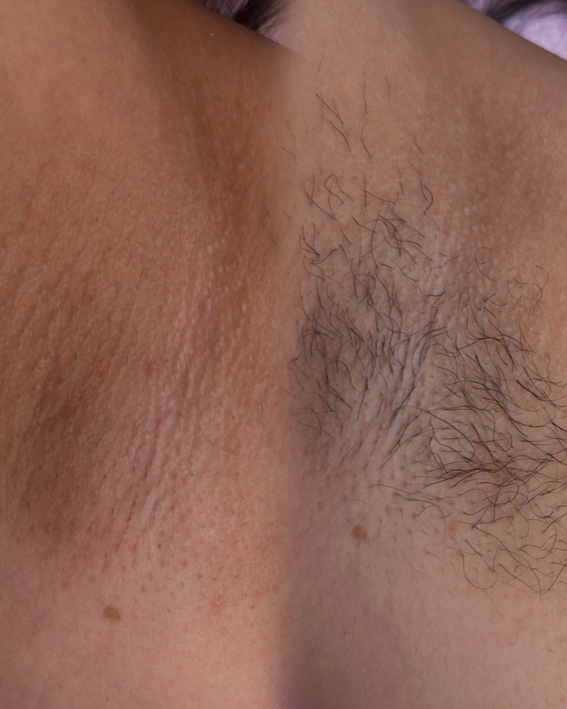 Underarm Wax