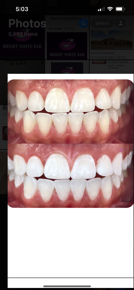 Signature Teeth Whitening Service