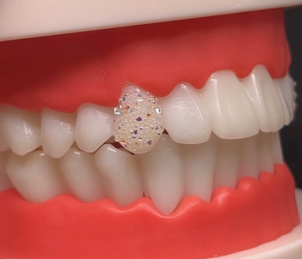 Iced Out Tooth
