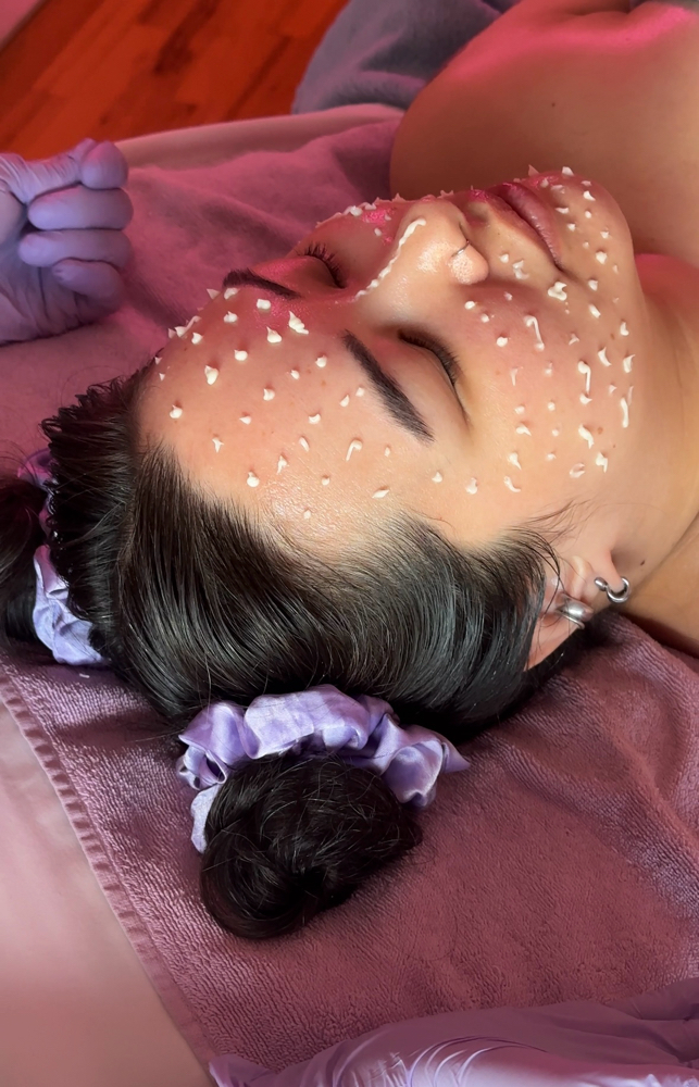 Cell Story (liquid microneedling)