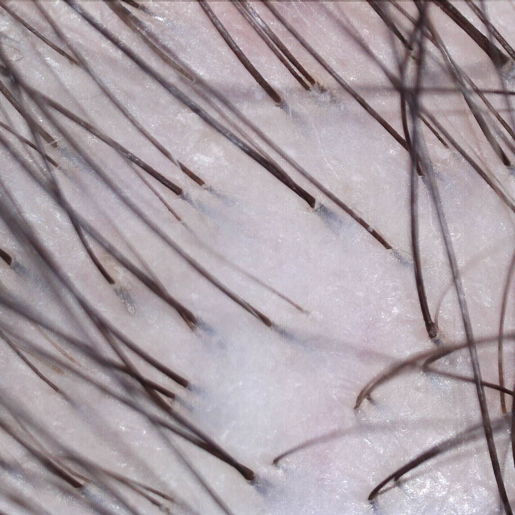 Progress Review & Imaging at Tri-City Hair Care in Richland, WA