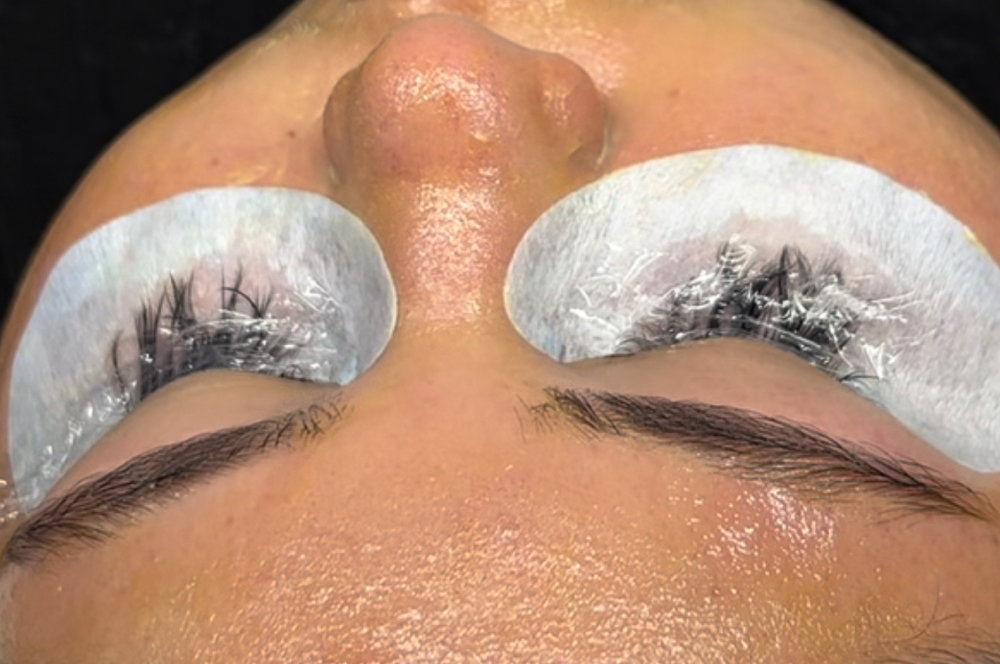 Lash Removal