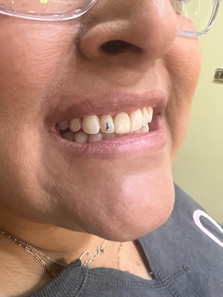 Tooth Gem Shape (Swarovski) at Lasting Impressions LHC in Lake Havasu City, AZ