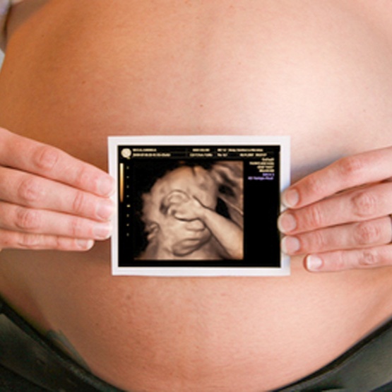 3D4D Ultrasound at Whittier 3D 4D Ultrasound by 4D Special Delivery in Whittier, CA