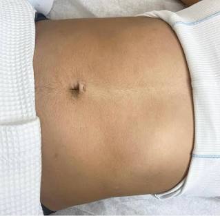 stomach