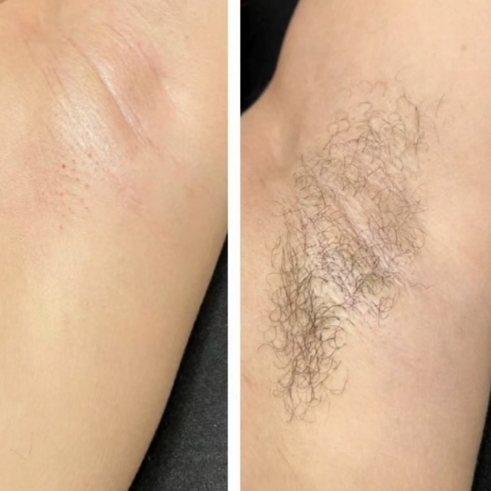 Underarm Waxing at CANELA STUDIO in CLIFTON PARK, NY