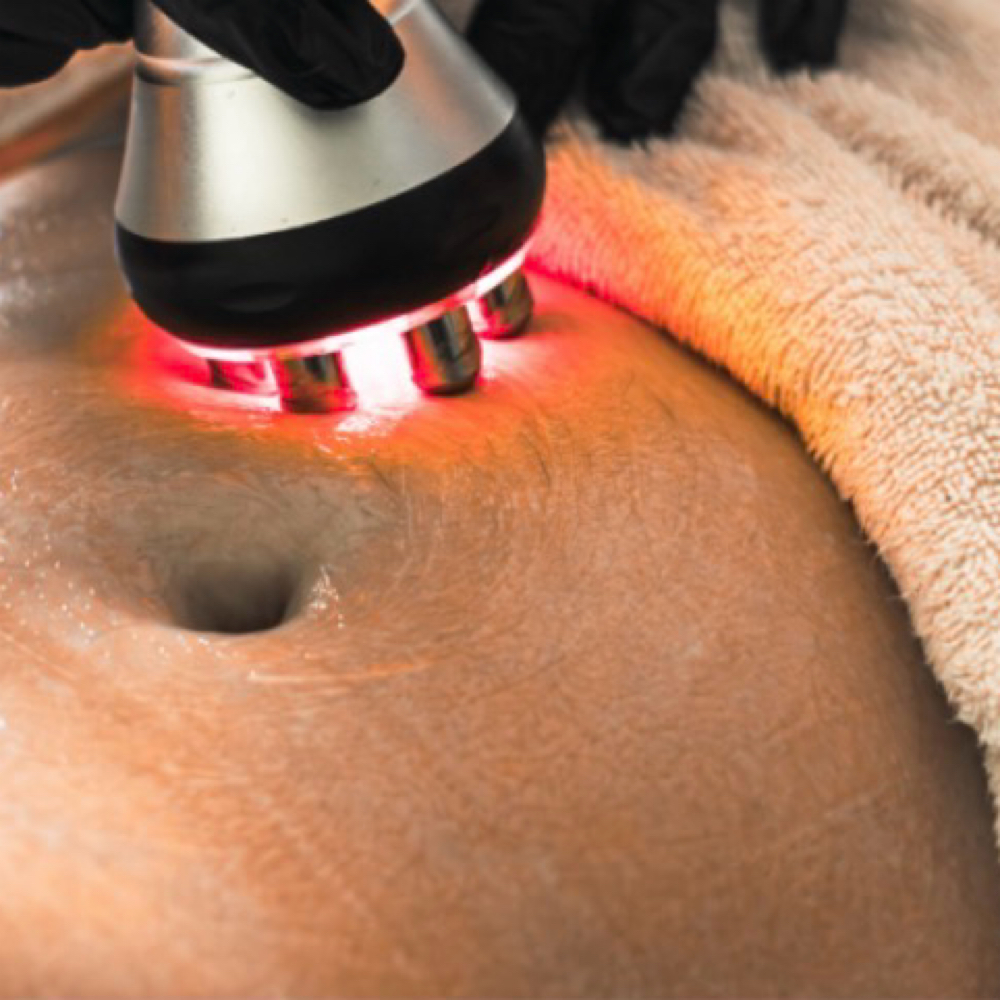 Skin Tightening (Single Area) at Elite Wellness Body & Skin Studio in Jackson, GA