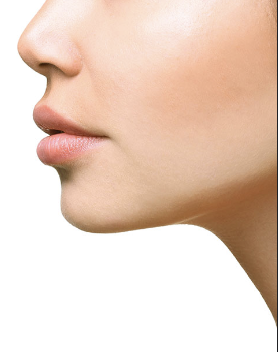Dermal Filler Chin