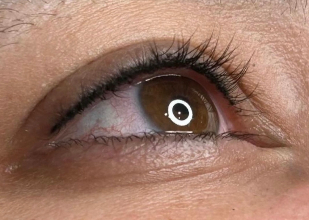Eyelash Enhancement