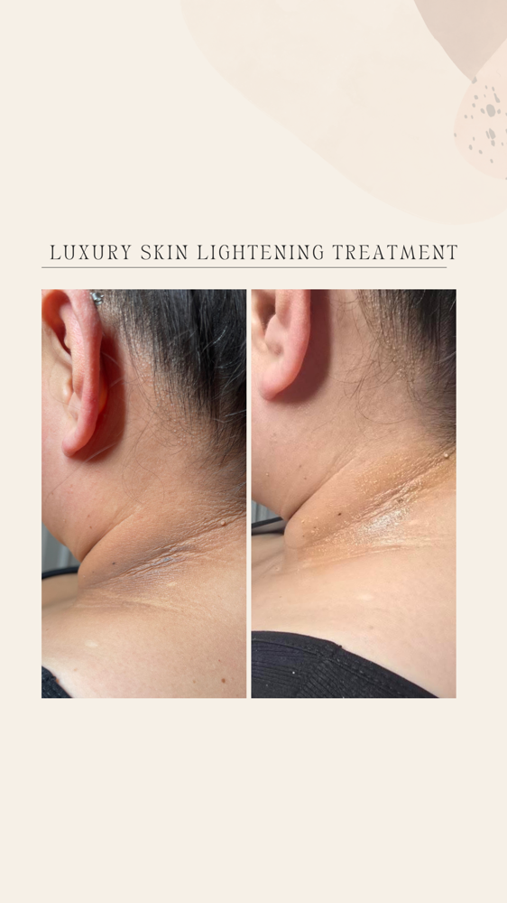 LUXURY SKIN LIGHTENING TREATMENT✨