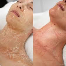 Melted Peptide Firming Facial