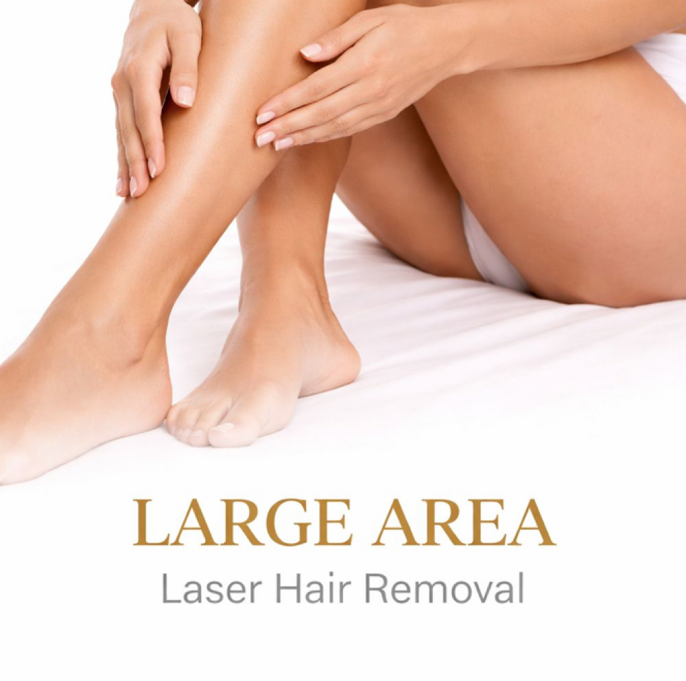 Laser Hair Removal - Large Area at Studios Secrets in Dallas, TX