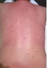 Men Back Wax