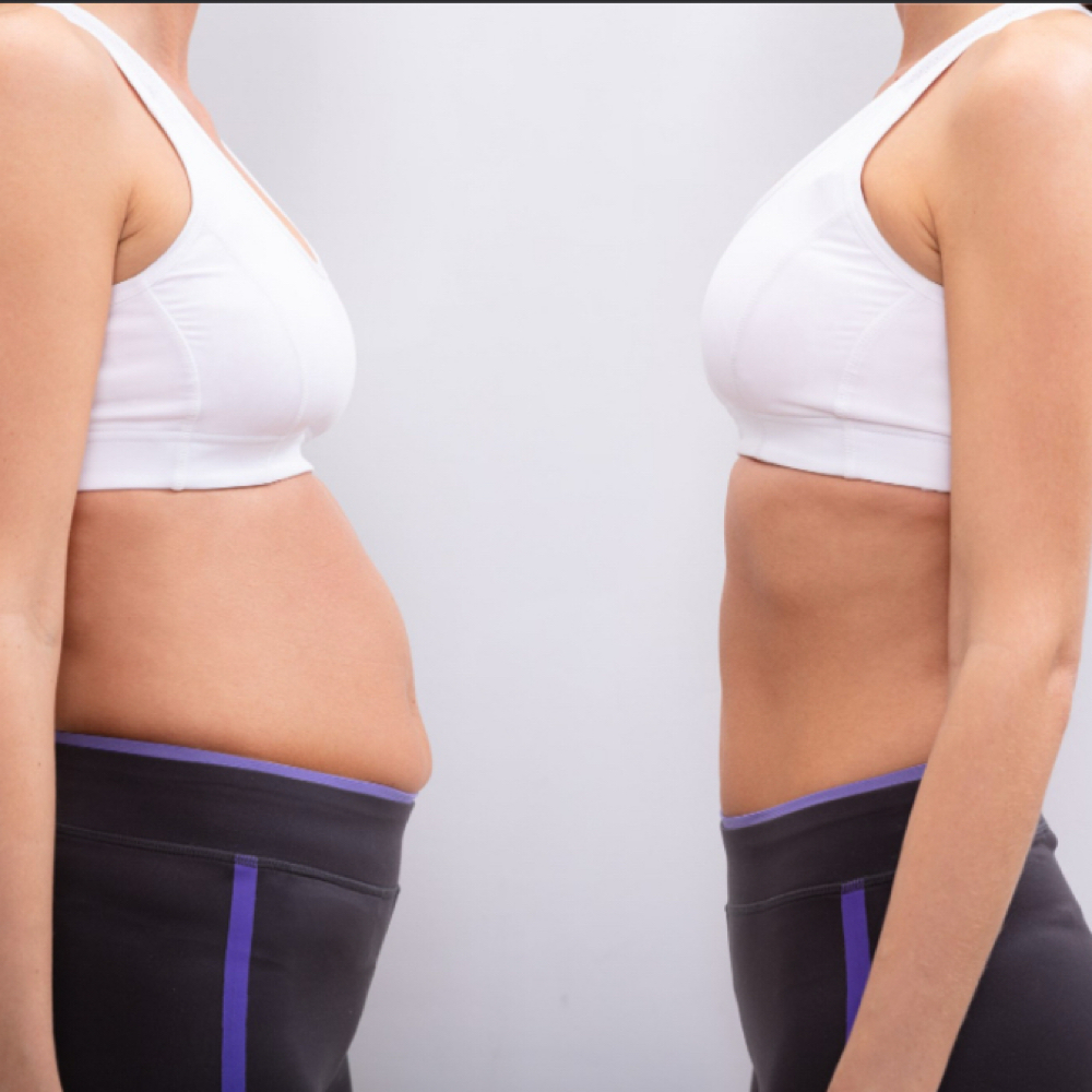 4D Sculpting™ 6 Weeks Program at EllaSana Wellness and Cryotherapy in Watkinsville, GA