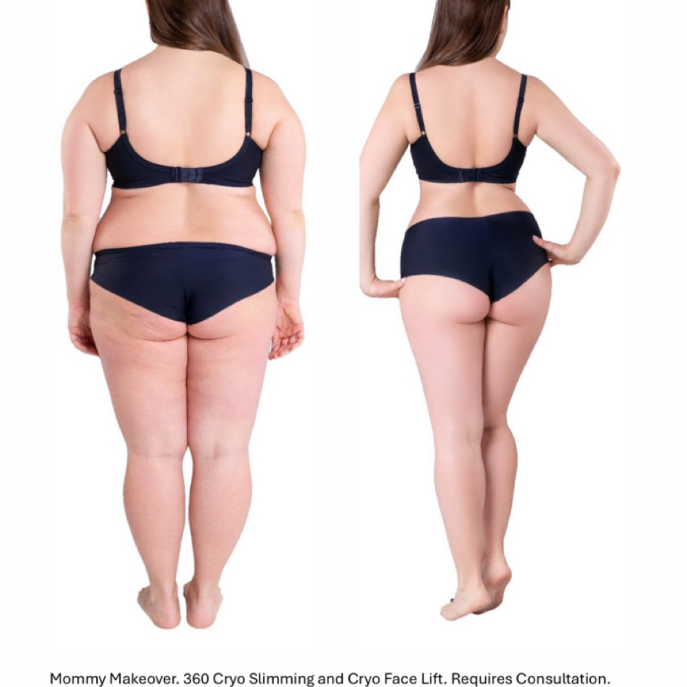 4D Sculpting  Method ™ at EllaSana Wellness and Cryotherapy in Watkinsville, GA