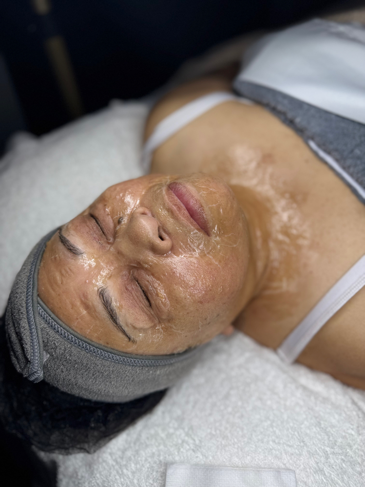 The Circadia Luxe Lift & Firm at Sarai Aesthetics in Plano, TX