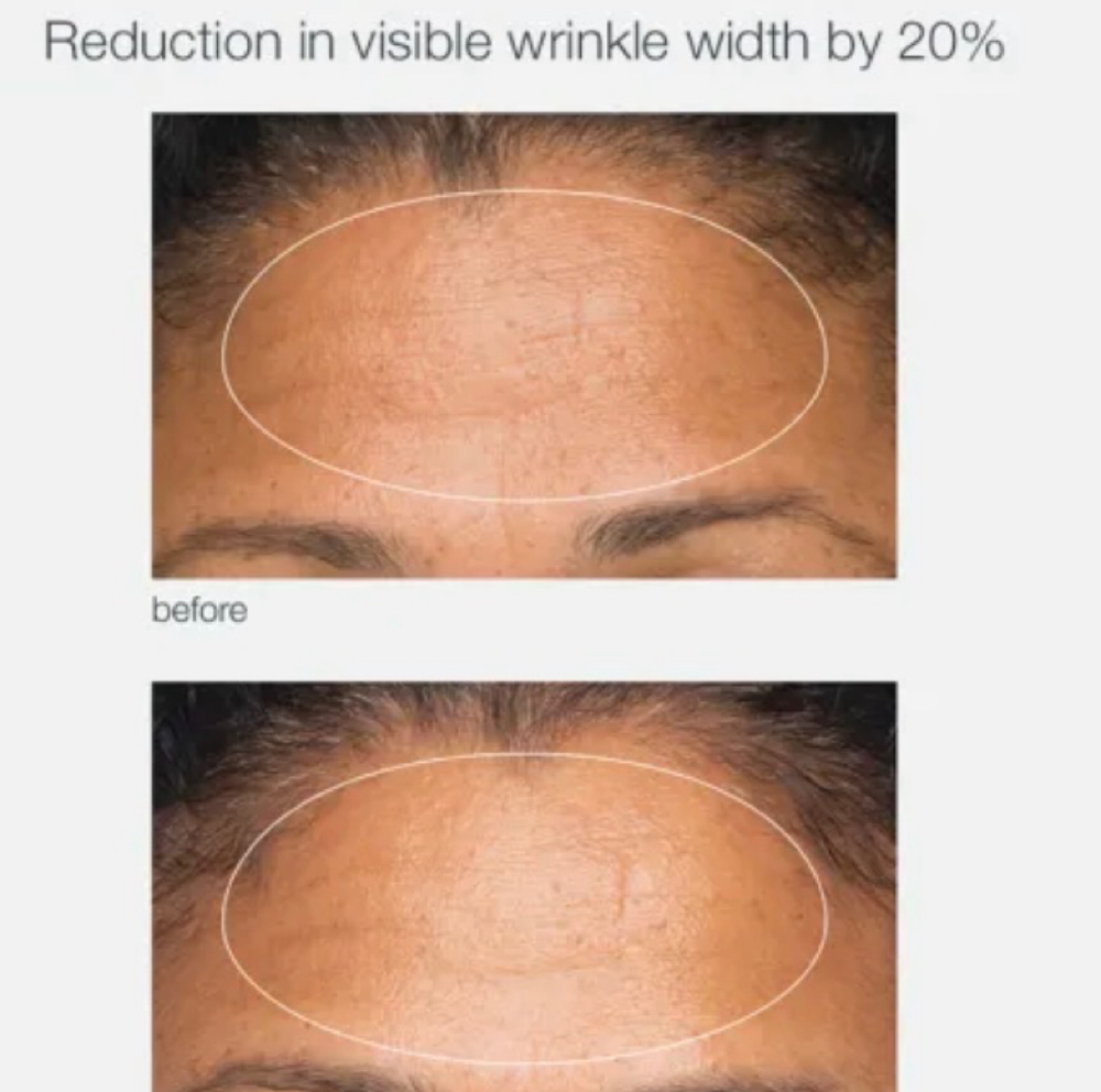 Pro Power Peel By Dermalogica at Nina Beauty&Brows Studio in North Hollywood, CA