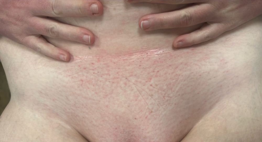 Brazilian Wax