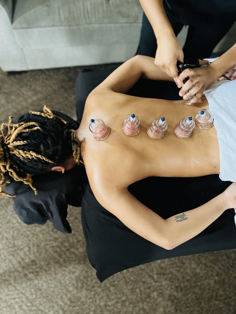 Cupping