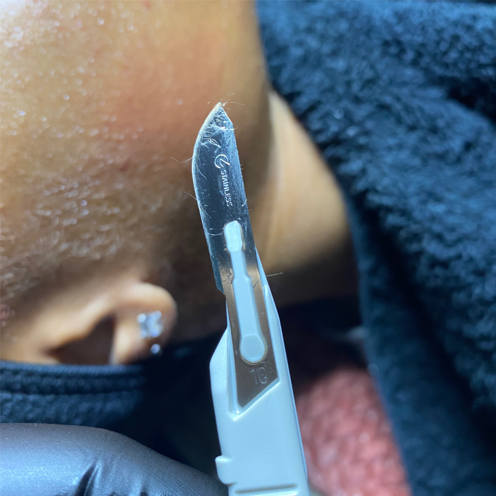 Dermaplaning at Vegan Luxe Esthetics in Houston, TX