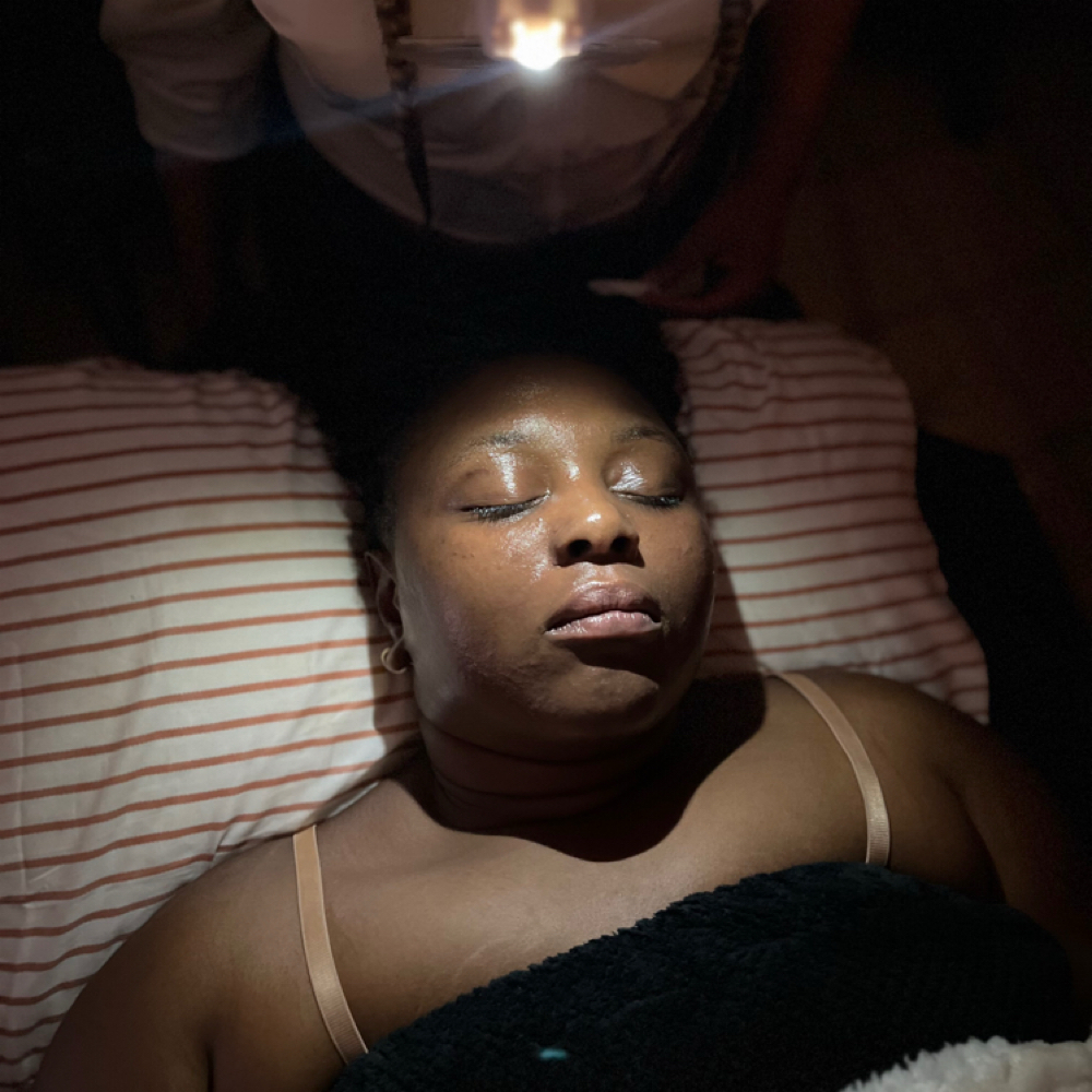 Dermaplaning With Enzyme Peel