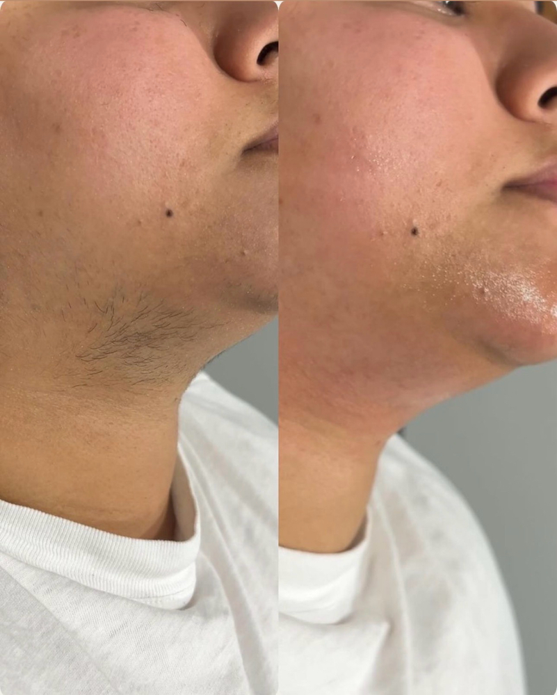 Chin Wax at Glow on the Go in Converse, TX