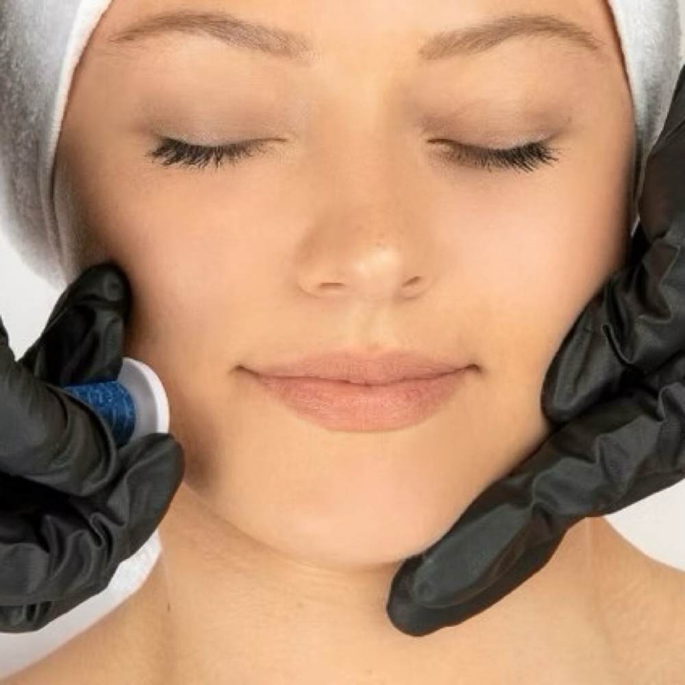Procell Microchanneling Facial at Bare Beauty Co. in Medford, OR