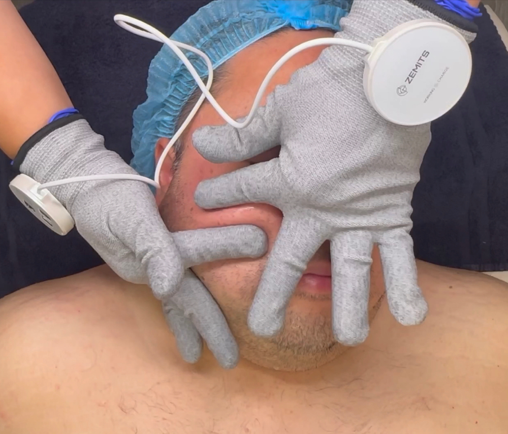 Microcurrent Facial