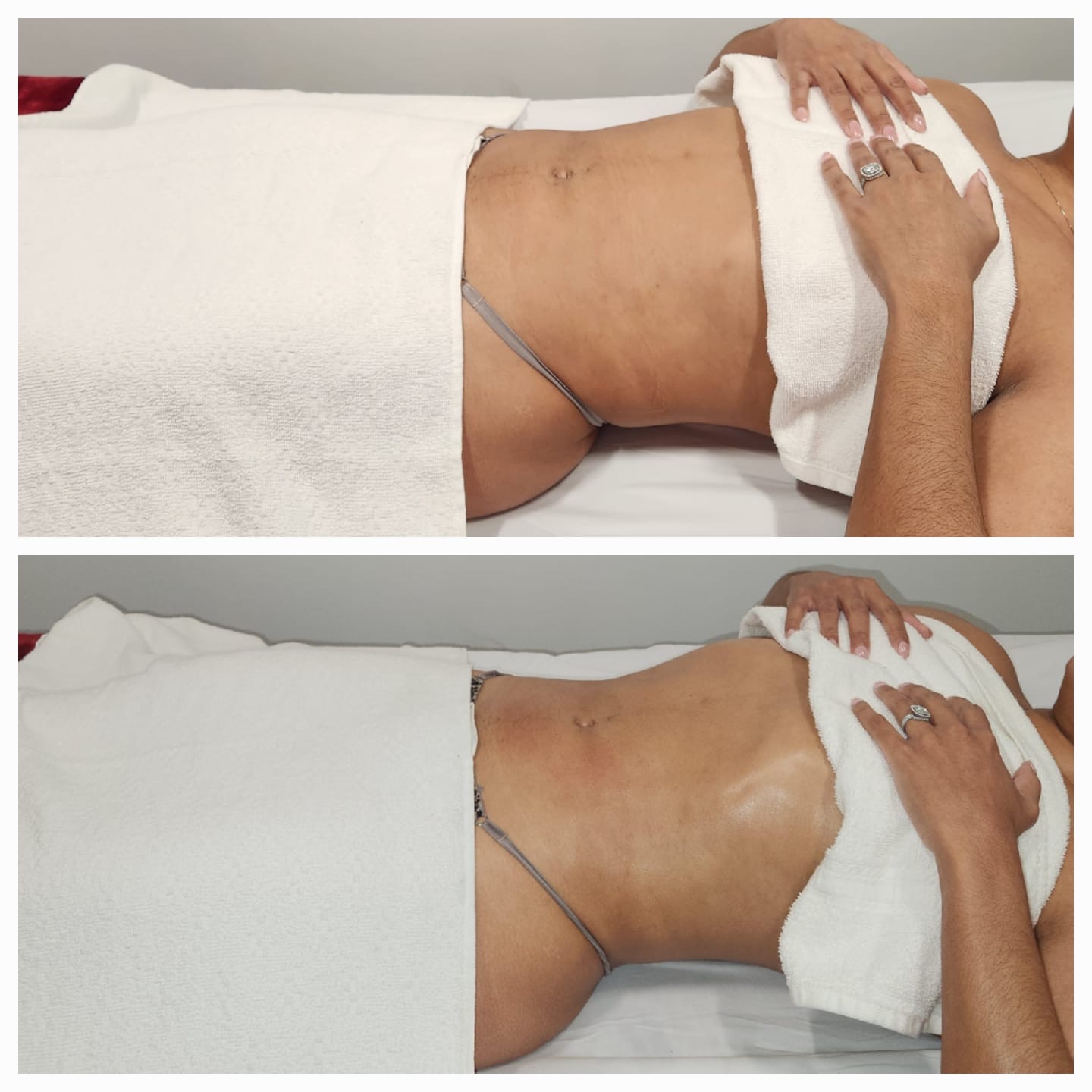 Brazilian Lymphatic Drainage (BODY)