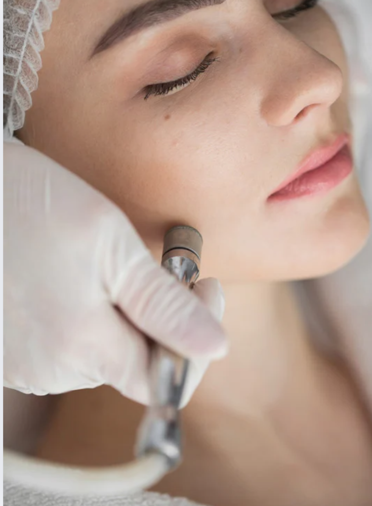 Microdermabrasion Facial