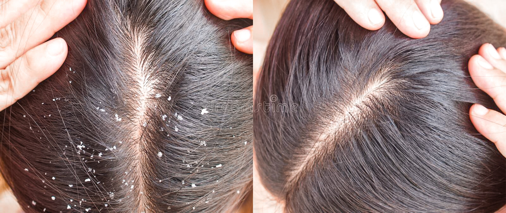 Scalp Treatment at Jackie Vay Hairstylist in Rochester, NY