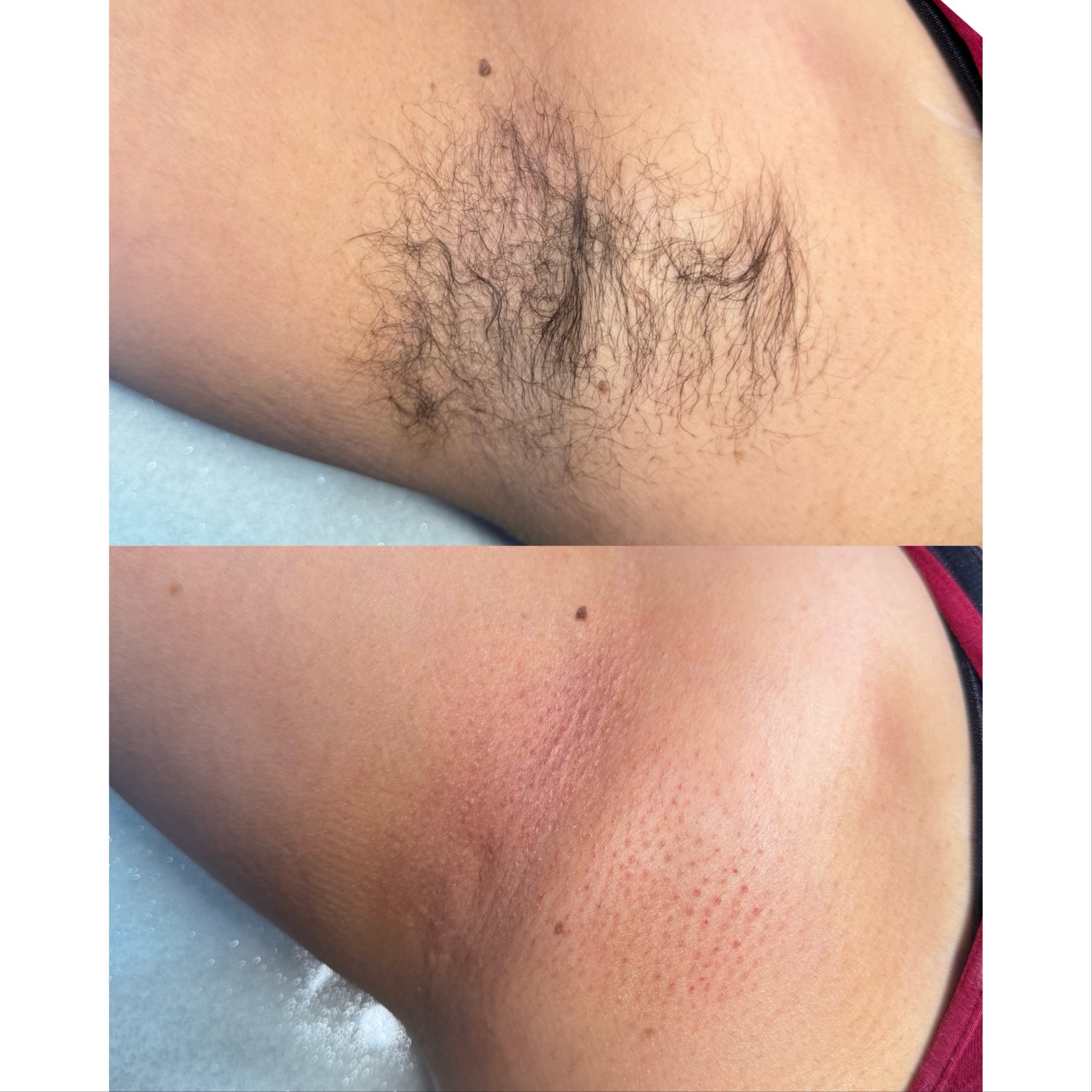 Underarms at Starlight Wax Studio in San Antonio, TX