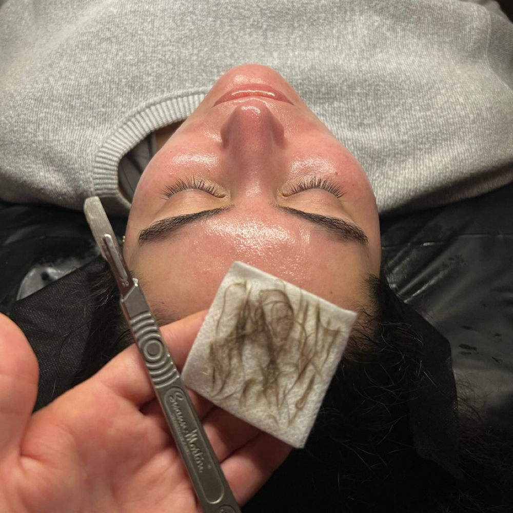 Dermaplane Facial at GlamourByMelanie in Sylmar, CA