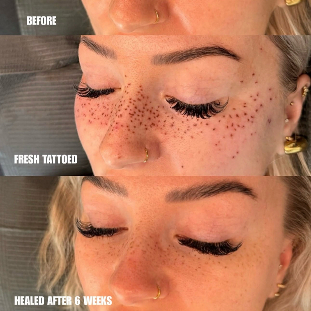 Full Face Of Tattoo Freckles at Amethyst Spa in Omaha, NE