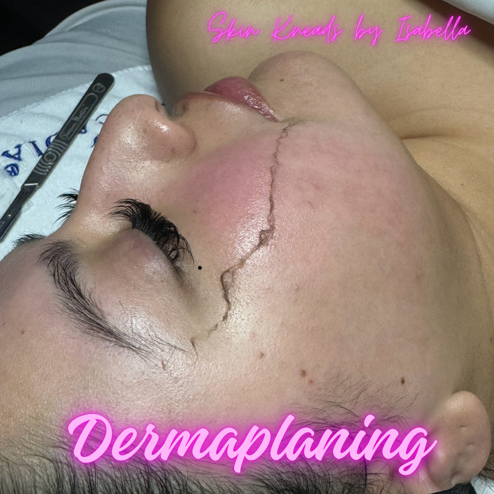 Dermaplaning Facial