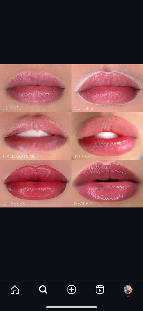 Lip Blushing