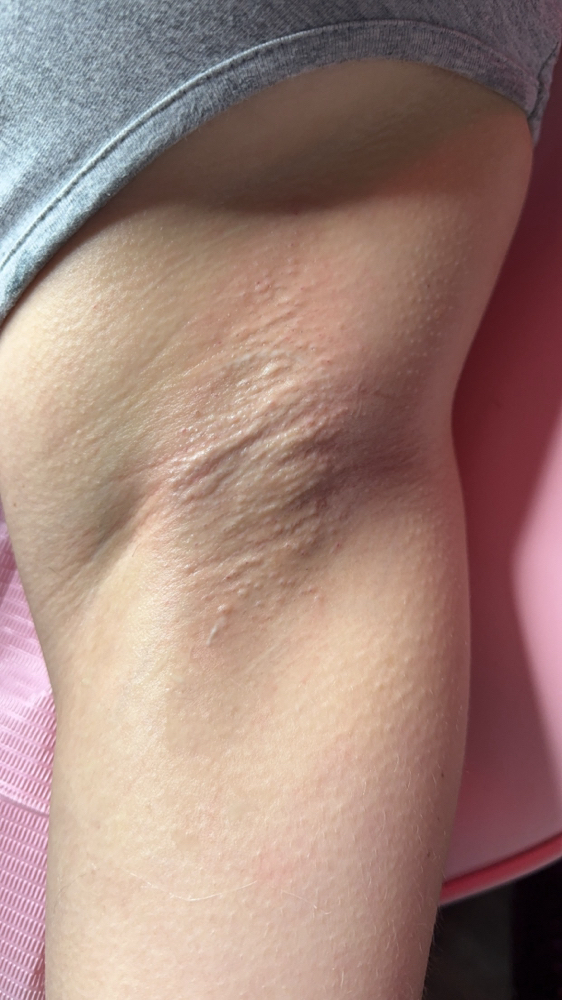 Underarm Wax at Luxx Beauty Lounge Co in Dallas, TX