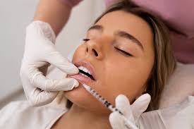 Lip Dermal Filler 1ml at Enhanced Beauty by Irma in Houston, TX