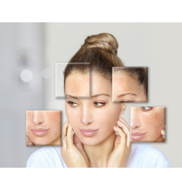 Complimentary Skin Analysis at LMK ESTHETICS SKINCARE SPA in Lake Ozark, MO