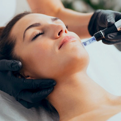 12- Microneedling w/ BioRePeel