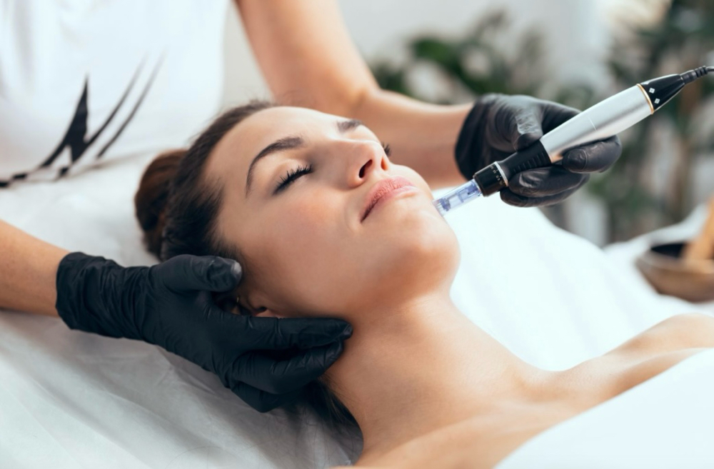 Microneedling Face