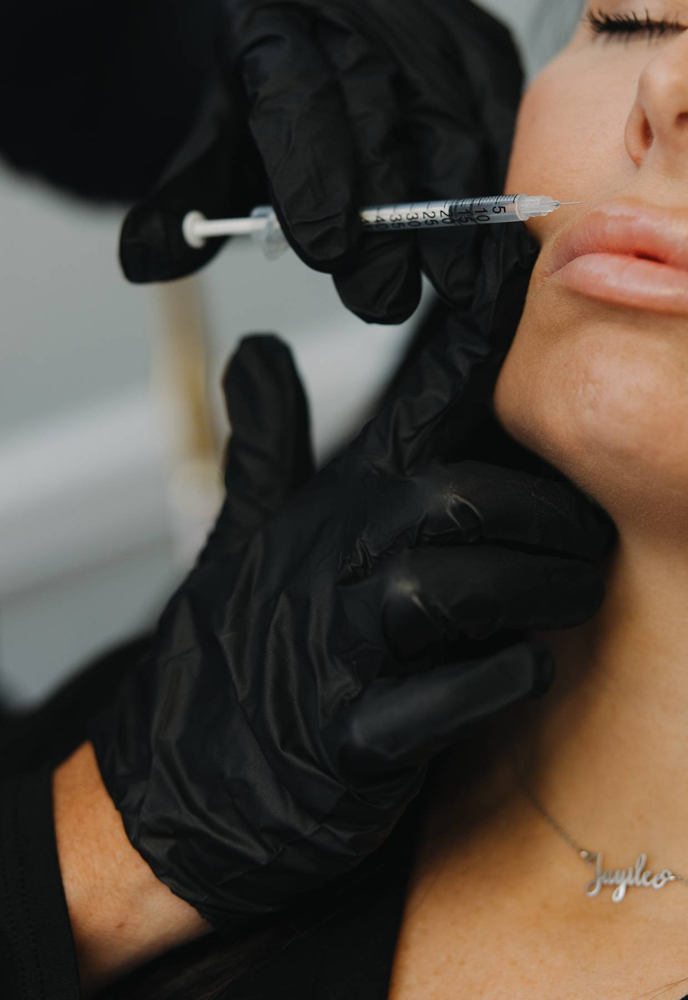 Subtle Lip Flip at By Grace Aesthetics & Wellness in Oneida, TN