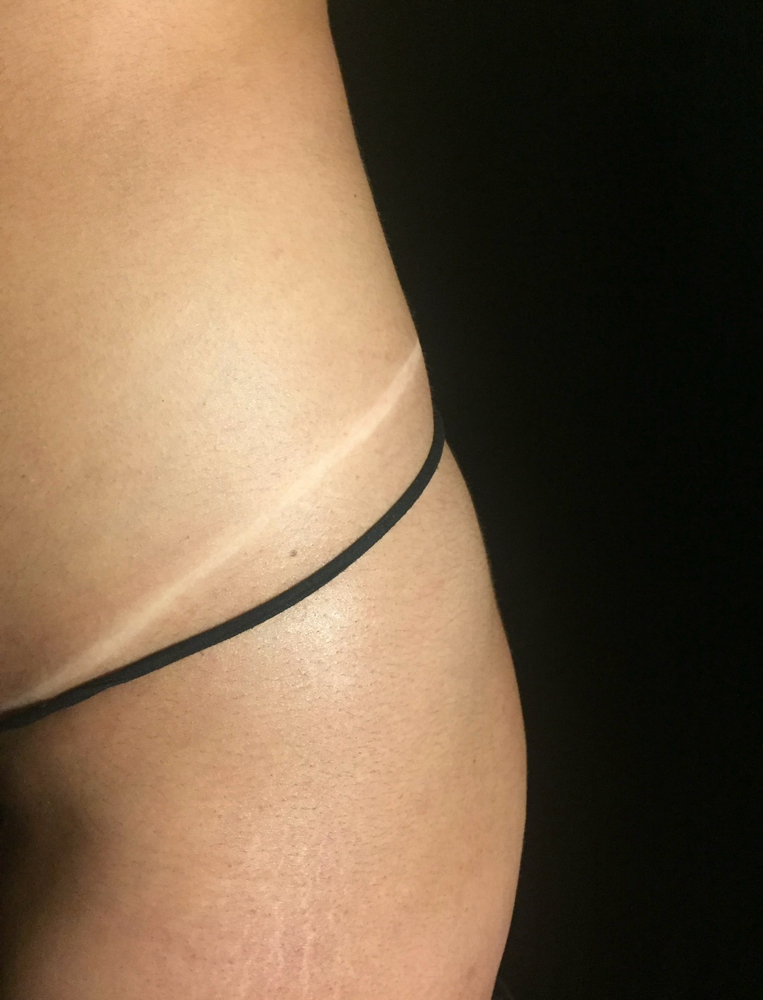 Signature Spray Tan