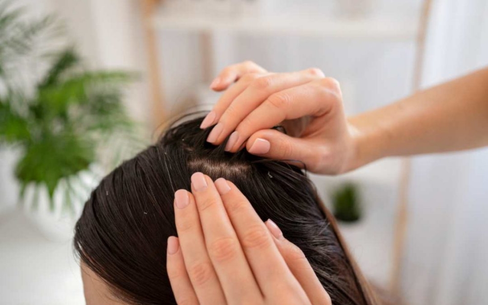 Scalp Treatment