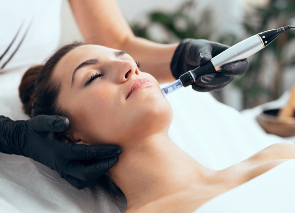 Microneedling