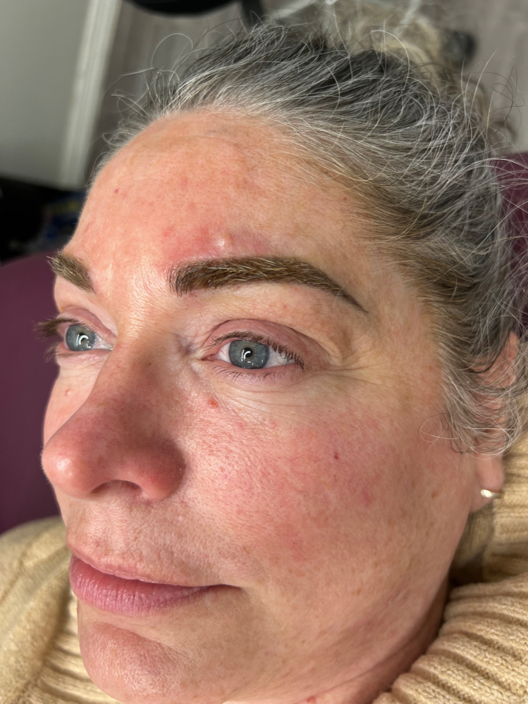 1 Year Touchup