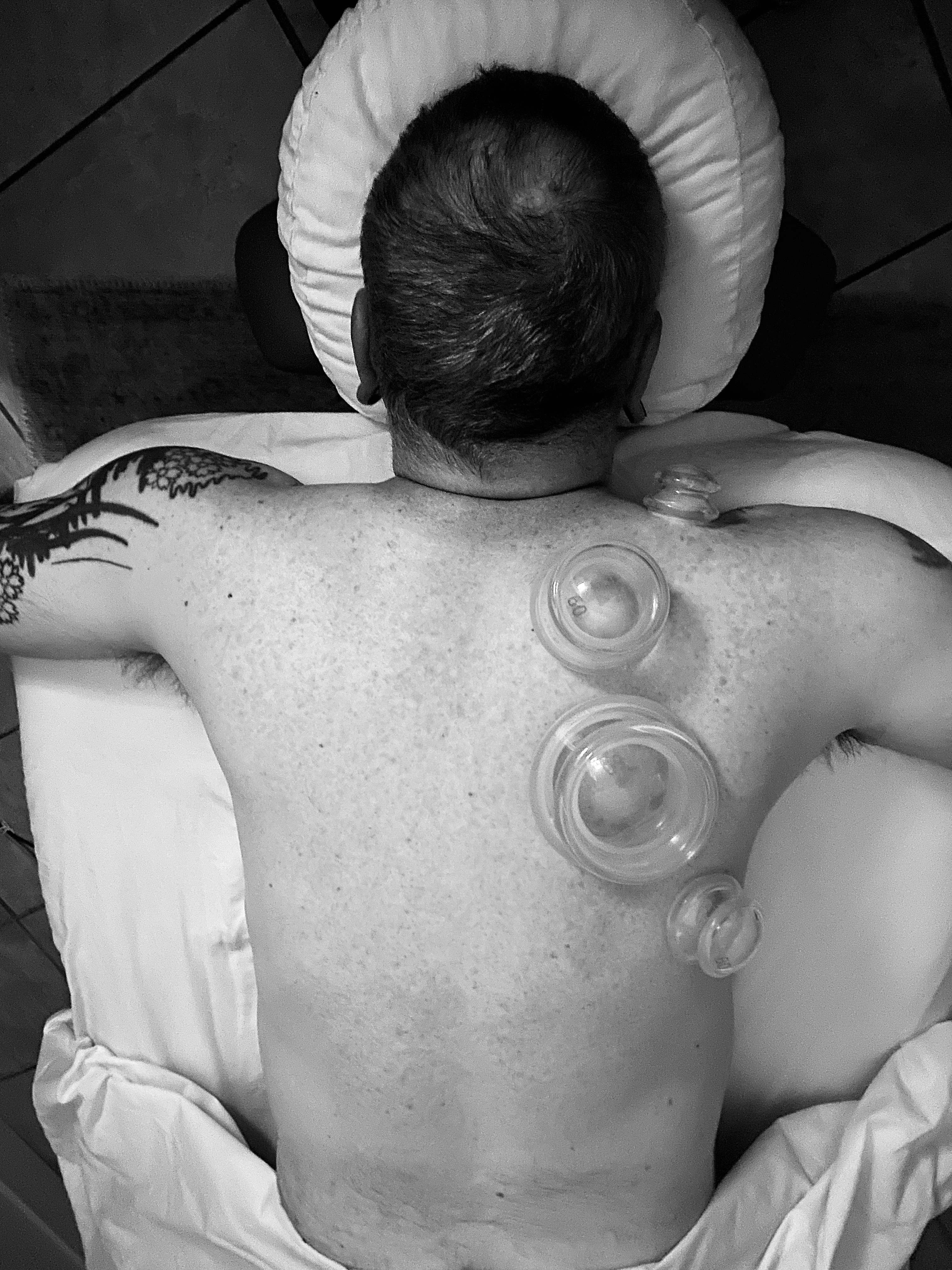 Cupping Therapy (Add-On Service)